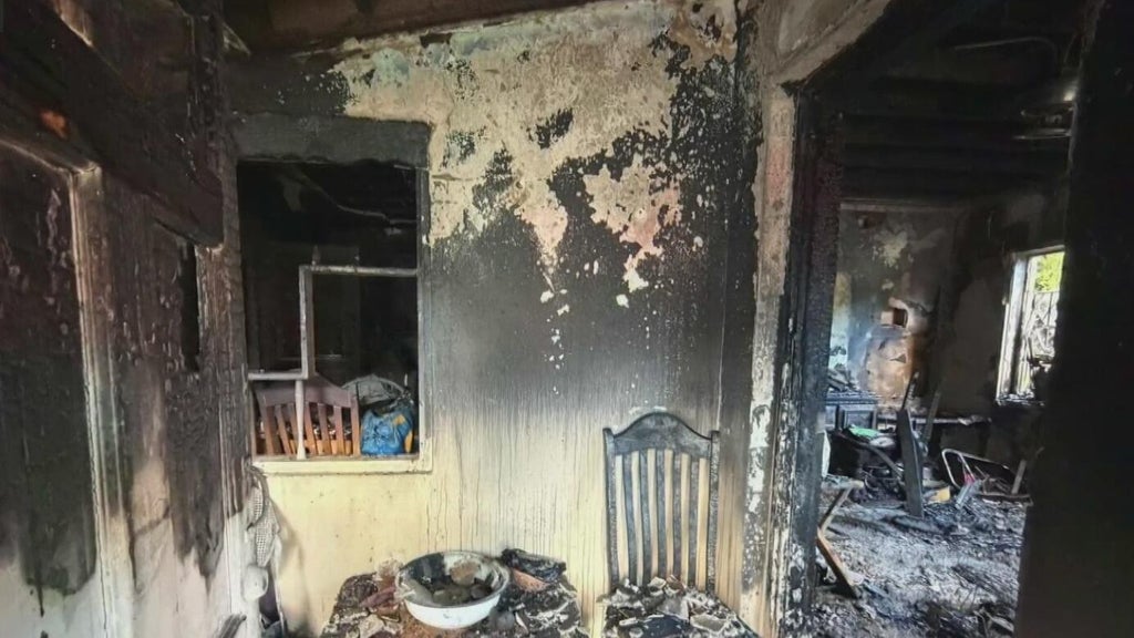 Woman hospitalized after Miami house fire leaves three displaced — CBS Miami, Coral Springs Health news