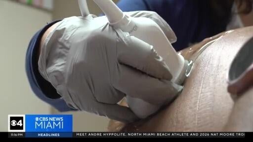 Birth rate for women over the age of 35, or mature pregnancies, is rising — CBS Miami, Coral Springs Health news